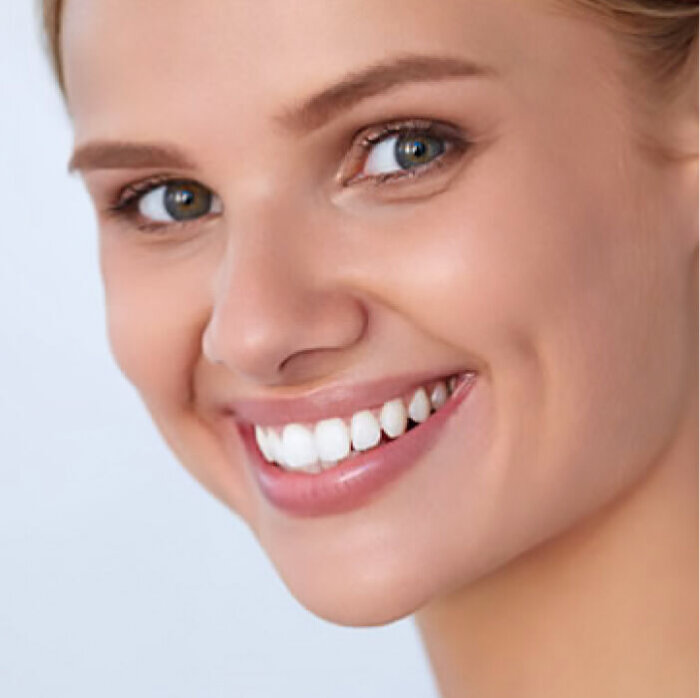 Purelywhite Deluxe image