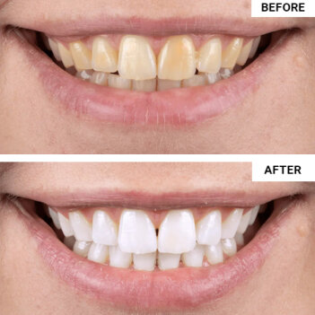 Purelywhite Deluxe image