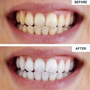 Purelywhite Deluxe image