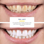 Purelywhite Deluxe image