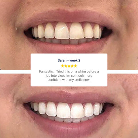 Purelywhite Deluxe image