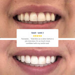 Purelywhite Deluxe image