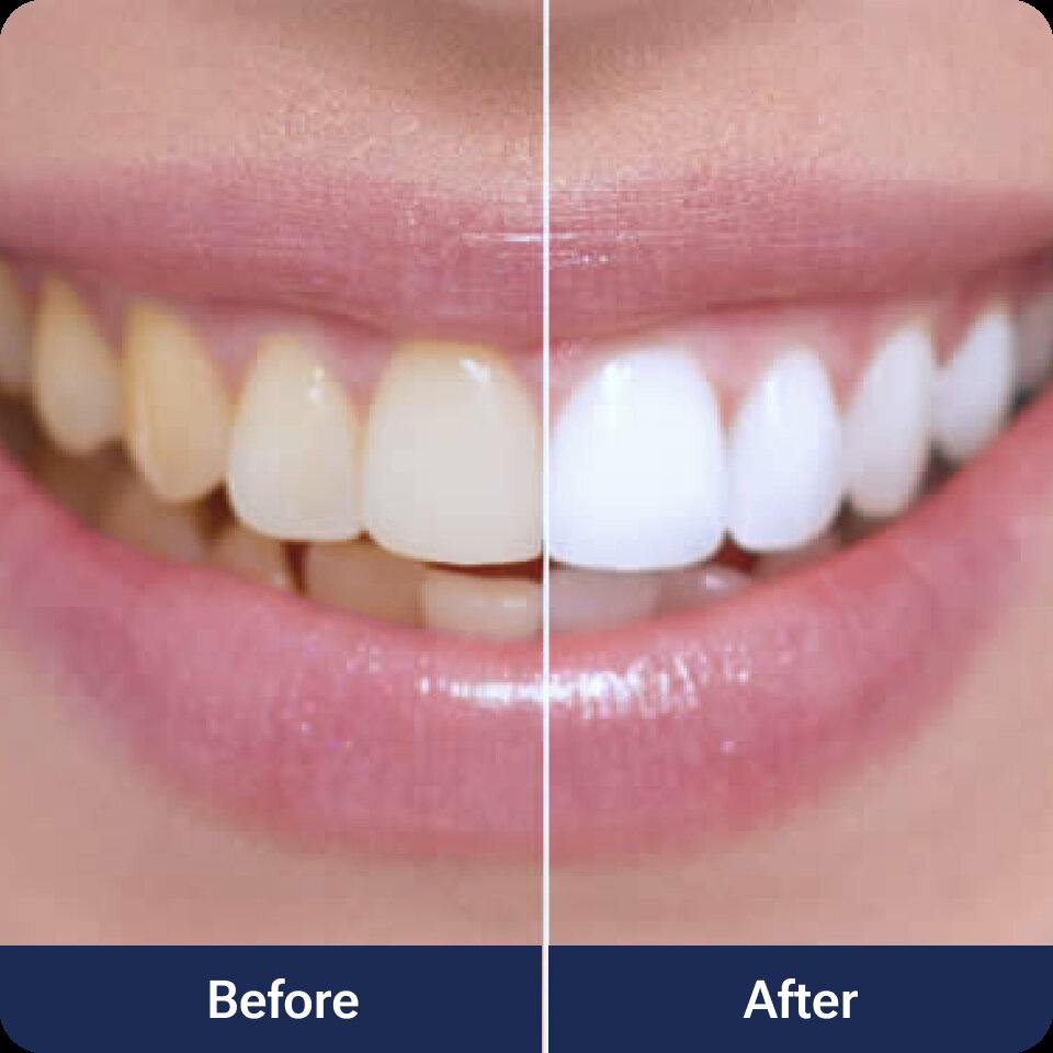 Purelywhite Deluxe image